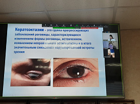 На кафедре офтальмологии и оптического приборостроения проходят обучение студенты Университета