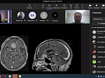 A meeting of the English MRI club in the diagnosis of diseases of the nervous system was held at the Department of Neurology