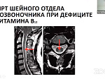 В БГМУ состоялась конференция «Актуальные вопросы неврологии»