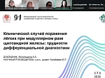 Состоялось совместное заседание научного кружка с участием кафедр пропедевтики внутренних болезней БГМУ и Ташкентского ГМУ 