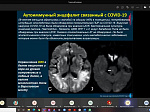 Междисциплинарная международная телеконференция по COVID-19