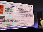 Офтальмологи БГМУ обсудили современные технологии лечения витреоретинальной патологии на конференции в Санкт-Петербурге